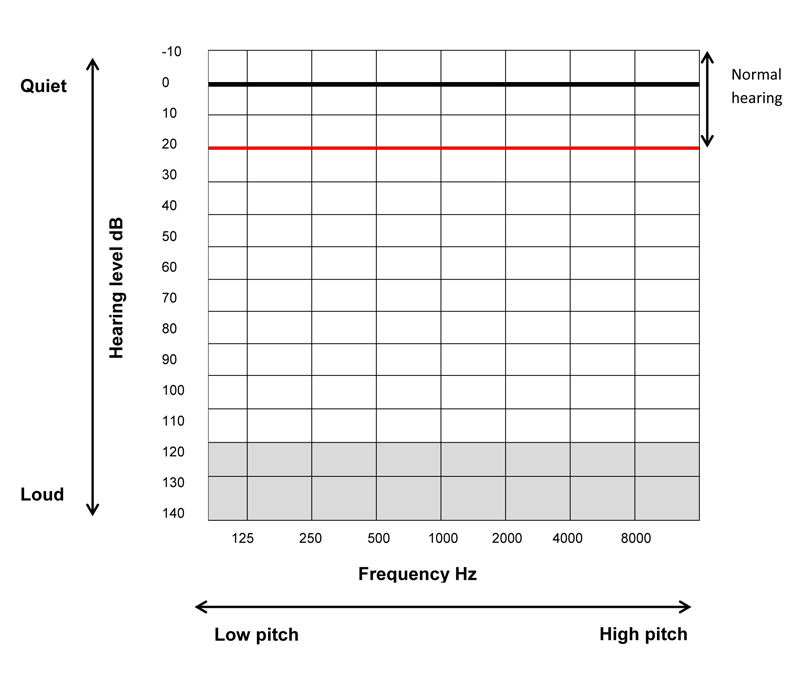 Hearing Graph